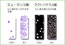 4．むし歯菌の検査